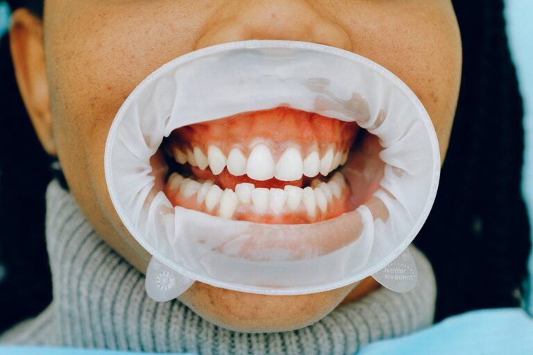 Gesunde Zähne, gesundes Leben: Die Bedeutung der Mundhygiene